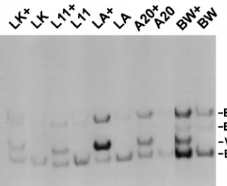 FIG. 1. Southern blot analysis of clonal isolates of the infected B- and T-celltumor lines