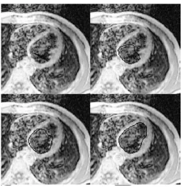 Figure 1.3: MRI application using ACM