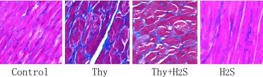Figure 2. Analysis of Masson’s staining results for myocardial tissues; The result of Masson’s staining in rats from each group (×400).