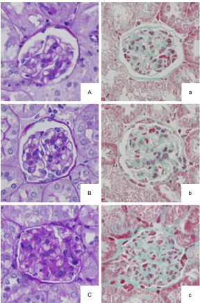 Figure 1. The sections were stained with periodic acid-Schiff (PAS) staining (A-C) or Masson trichrome staining (a-c) and visualized at 400× magnifica-tions