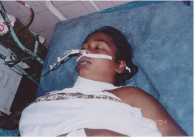 Fig 8: A post operative patient with respiratory difficulty, 