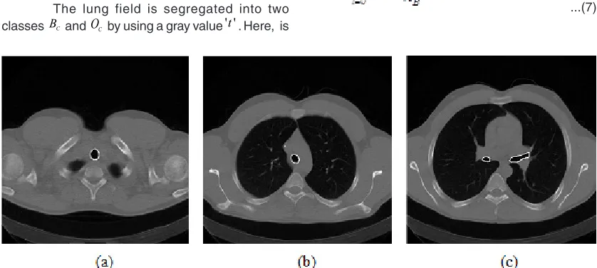 Fig. 3: The segmentation of airways in upper, middle, and lower slices in a CT scan respectively.