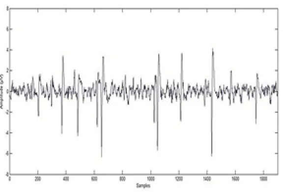 Fig. 1: 1D EEG Signal