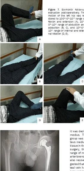 Figure 7. Six-month follow-up flexion and extension (A), 10°-evaluation post-operatively