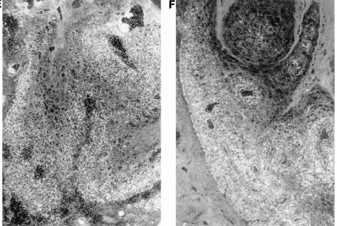 FIG. 1. Immunohistochemical staining of CD8�and in situ hybridization were as described in Materials and Methods