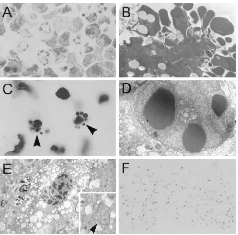 FIG. 2. (A) CVS-infected AT3 cells 5 days after adsorption of virus. Typical morphologic changes of apoptosis are demonstrated in many cells, with condensationof nuclear chromatin, which is frequently distributed in multiple discrete masses at the nuclear 