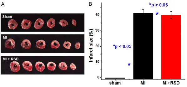 Figure 2. H&E (hematoxylin and eosin) staining of the renal artery and sur-rounding nerves with or without RSD (renal sympathetic denervation)