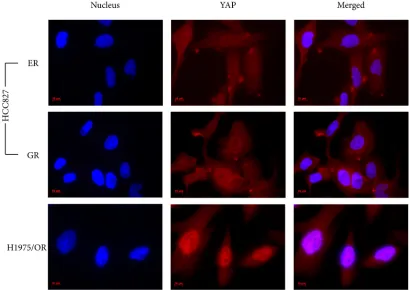Figure 3: An immunocytochemistry staining showing the localization of YAP in drug-resistant sub-lines