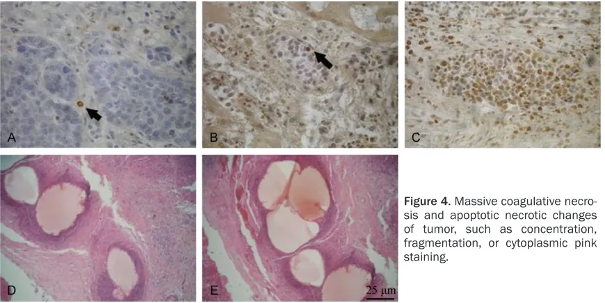 Table 2. VEGF staining and MVD counts in differ-ent groups