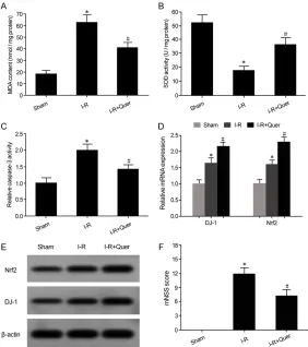 Figure 1. Brain OS upregulated and caspase-3 activity enhanced in I-R model rats. (A) MDA content in the rat brain tissue; (B) SOD enzyme activity in rat brain tissue; (C) Caspase-3 activity in rat brain tissue; *P < 0.05, compared with the Sham group.