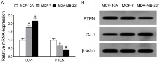 Table 1. Effects of Cur on the proliferation activity of MCF-10A, MCF-7 and MDA-MB-231 cells