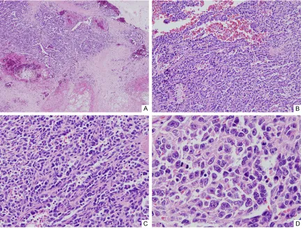 Figure 1. Results from radiological and gross examination. A and B. Computed tomography of abdomen