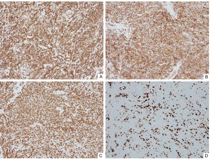 Figure 3. Results from immunohistochemical staining of specimens for the proteins: A. CD31; B