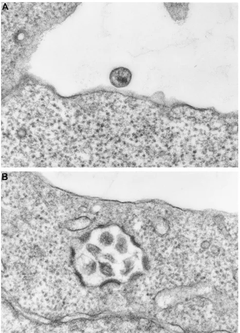 FIG. 3. Electron microscopy. (A) Wild-type virus; (B) R39E,R43E mutant virus. Mutant R39E,R43E shows some relocalization away from the plasma membranetoward internal membranes.