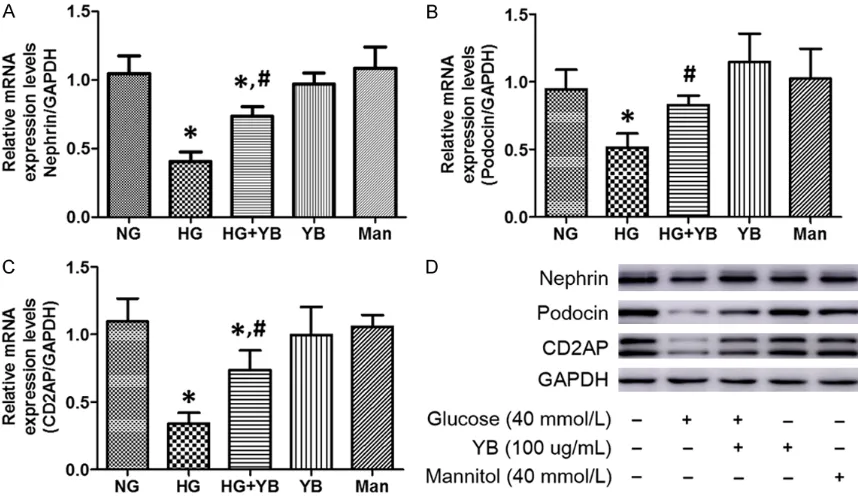 Figure 1. Cell viability assays. A. Podocytes were cultured in serum-free medium with normal glucose (NG, 5.5 mmol/L), high glucose (HG, 40 mmol/L) or mannitol (Man, 40 mmol/L) for 24 hours