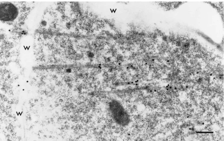 FIG. 2. Array of tubules in a procambial cell in an immature pumpkin leaf systemically infected with SqLCV