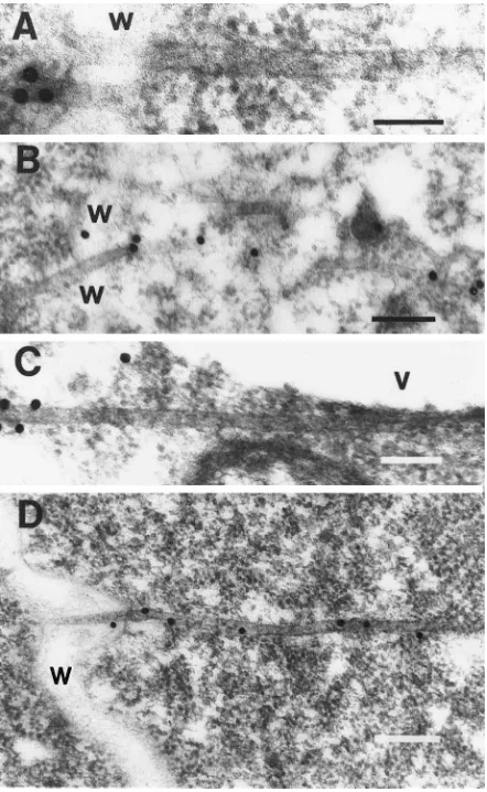 FIG. 4. Labeling of tubules with antisera to movement proteins and proteinA-gold. (A) Anti-BL1 antisera; (B) anti-BR1 antisera; (C) preimmune serum