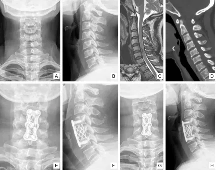 Figure 2. Typical imaging data. F, 40 y, both upper limbs pain and numbness for 1 year, aggravated for 2 months