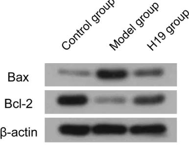 Figure 7. Upregulation of lncRNA H19 expression on caspase3 activity in 16HBE cells; Compared with control group, *P<0.05; compared with model group, #P<0.05.