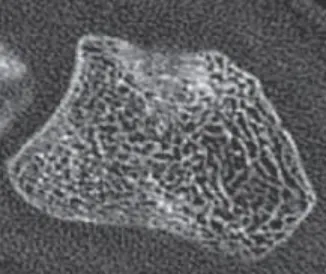 Figure 1.2-High Resolution CT scan of trabecular bone at 200um. Grainy image is due to noise in the image signal