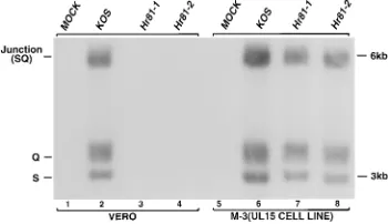 FIG. 5. UL15 mutants fail to process concatemeric replicating DNA to mo-nomeric viral genomes