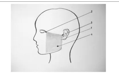 fig. 3. diagram of motor points of the actual chewing muscles to hold myotonometry: where, 1 is a transparent plate; 2 – the lateral edge of the orbit; 3 – the tragus of the ear; 4 – motor point of actually chewing muscles