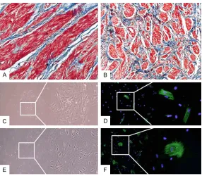 Figure 1. Fibrosis of megaureter tissues and α-smooth muscle actin staining of primary cultured SMCs
