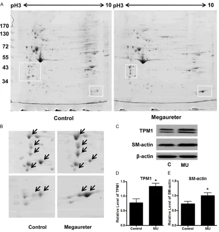 Figure 2. 2D analyses and TPM1 expression in primary cultured SMCs of megaureter and control ureters
