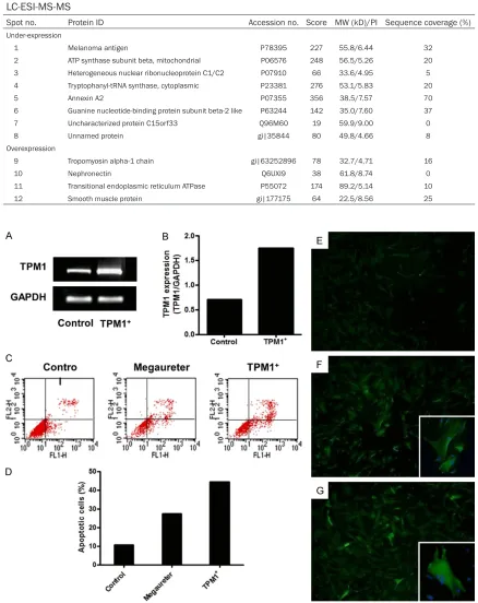 Table 1. Differentially-expressed protein spots between megaureter and control SMCs by nanoflow LC-ESI-MS-MS
