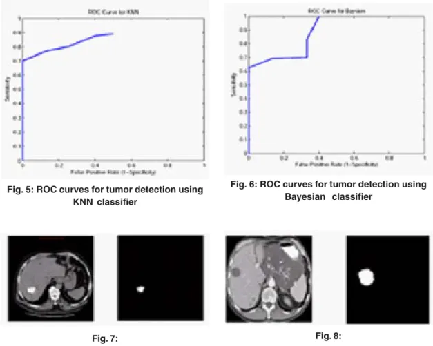 Fig. 5: ROC curves for tumor detection using KNN classifier