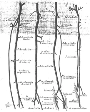 Fig. 1  : VARIATIONS IN THE BRACHIAL ARTERY  (McCORMACK et al.,  BRACHIAL ARTERIAL PATTERNS) 