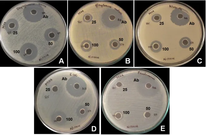 Fig. 3. Graphical representation depicting the zone of inhibition formed against selected gram positive and gram negative bacterial strains by different concentrations of partially purified chitinase from Trichoderma viride
