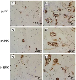 Figure 2. mRNA expression of miR-144 and titin-Ab in placental tissue. A: Expression of miR-144; B: Expression of titin-Ab