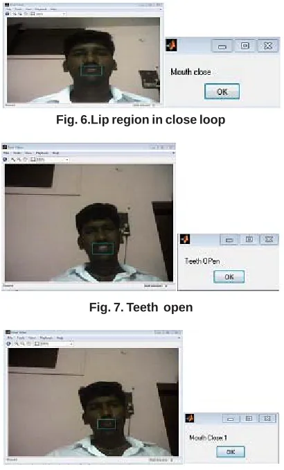 Fig. 6.Lip region in close loop