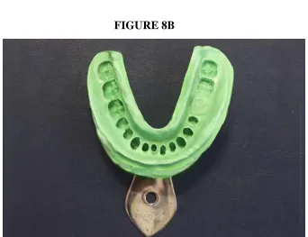 FIGURE 8A & 8B     