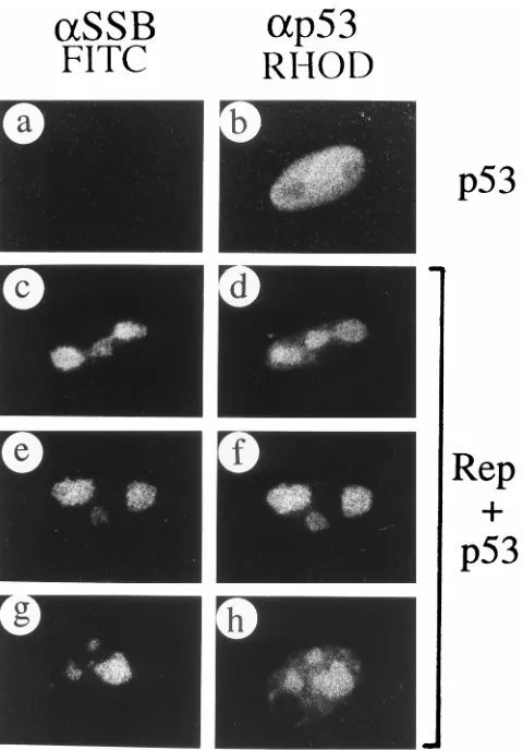 FIG. 9. Redistribution of cotransfected p53 protein by assembled RC. (a andb) Plasmid pSVp53 transfected alone; (c to h) cotransfection of pSVp53 and the
