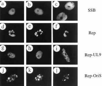 FIG. 2. Assembly of HSV RC in cotransfected cells. All panels show three examples of single-label IFA patterns for SSB detected with rhodamine-labeled anti-SSB39S MAb in transfected Vero cells