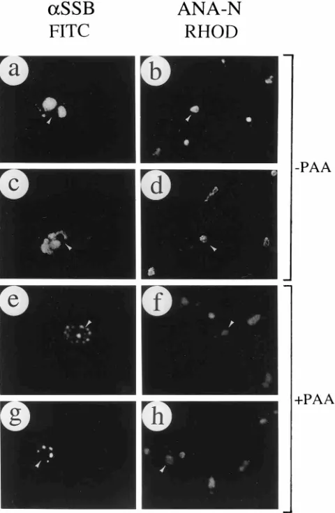 FIG. 3. HSV oriS-dependent transient DNA replication assay in cotrans-fected Vero cells receiving all seven essential viral replication proteins