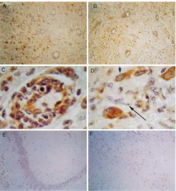 FIG. 3. Immunohistochemical detection of GFAP (A) and iNOS protein (B to F) in the CNSa of B6 mice at 6 (A to D) and 42 (E and F) days p.i