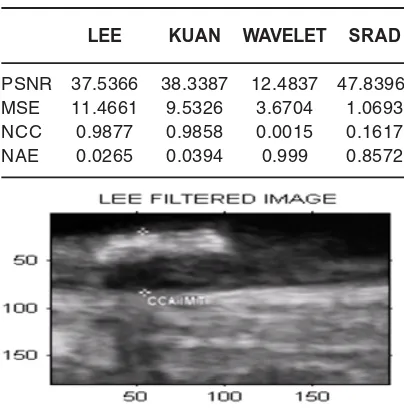 Table 2: Perfomance of Filters For UpperCropped Image