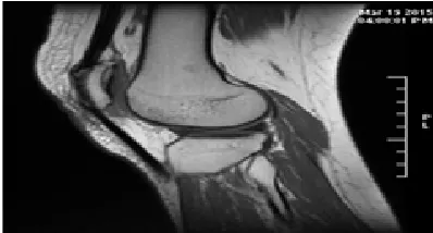 Fig.1. MR Image of a Human Knee Joint