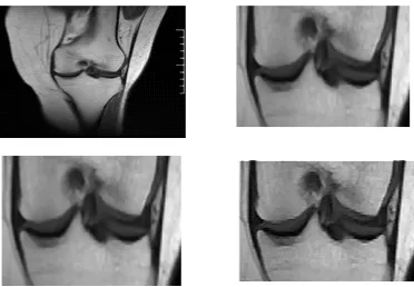 Fig, 5. (A) Noise sifted picture of sagittal plane, (B) Cropped Image of sagittal plane, (c) Resize of edited picture 1.5 times in sagittal plane and (D) Sharpened picture of sagittal plane