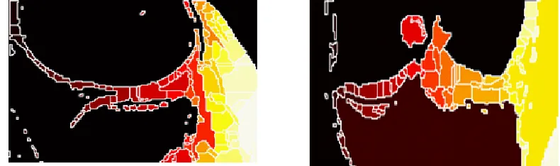 Fig. 7. (a) Binary image of sagittal plane based on pixel properties, (b) Dilated version of the binary image extracted previously