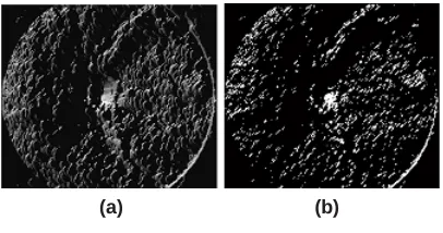 Fig. 2(b). For the retinal image pixels in quadrants I