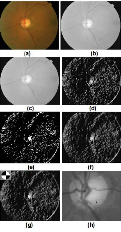 Fig. 6: (a)Input Image, (b)LAB - L Component,(c)Smooth Image, (d)Orientation map (e) Binaryorientation map (f) Circular Convolution(g)Peakcircular convolution mask(h) Detected OpticDisc