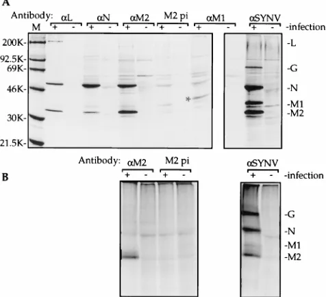 FIG. 3. Coimmunoprecipitation of SYNV proteins from extracts of SYNV-infected protoplasts with SYNV-speciﬁc antisera