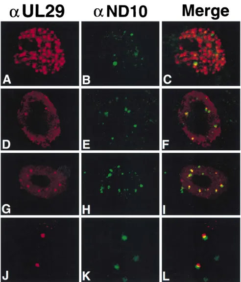 FIG. 6. Localization of UL29 in cells transfected with UL29 in the presence or absence of the helicase-primase complex