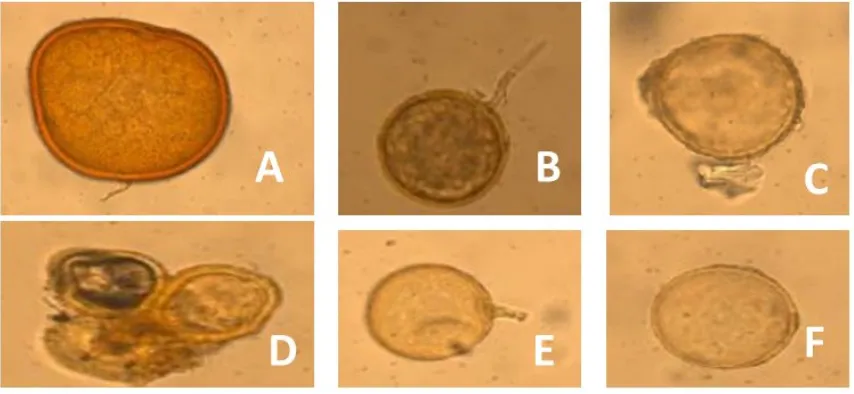 Figure 1. A: Stained root of date palm with associated soil mycelium of AMF. B: Stained root of date palm with intercellular mycelium and arbuscules of AMF.