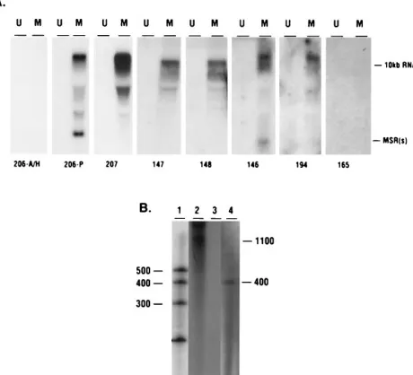FIG. 9. Northern blot analysis and RPA to map the 10-kb RNA. A 15-�portion of total RNA puriﬁed from uninfected CEF (U) and MSB1 cells (M) wasseparated on 1.6% agarose–formaldehyde gels and transferred to nitrocellulose.The positions of the 10-kb RNA and t