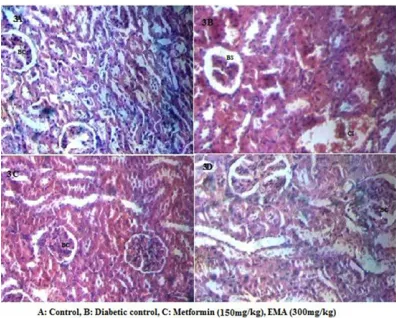 Fig. 3. Effect of Morus alba on histopathology of kidney